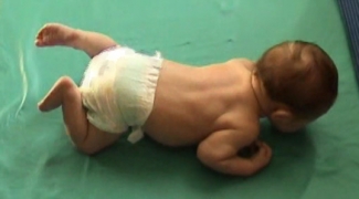 Will 5w prone lift head 10.jpg